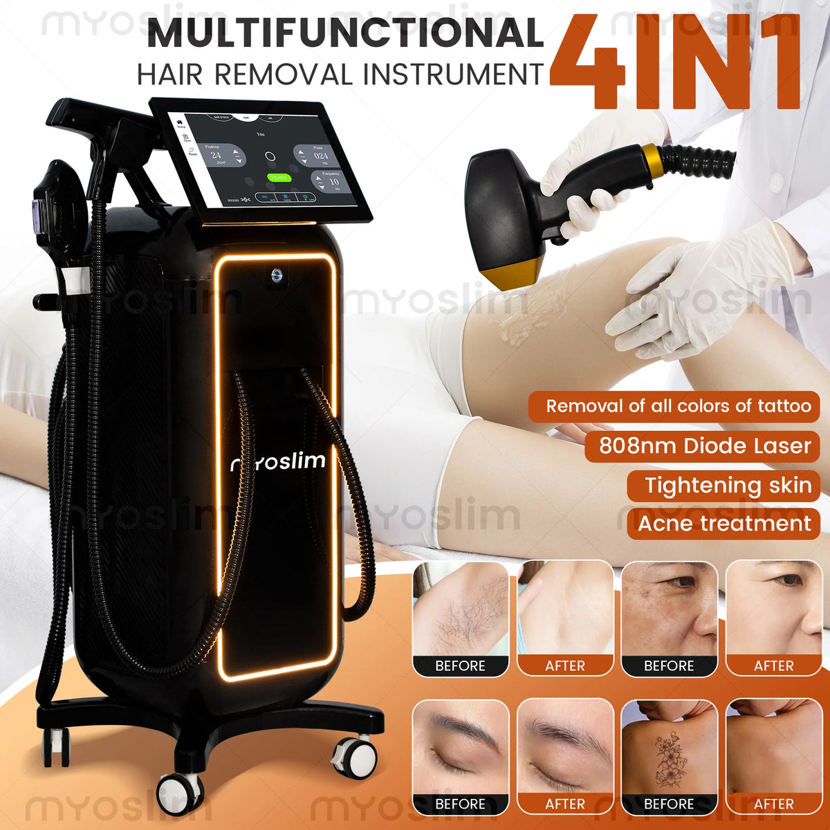 MYOSLIM Four Wave Diode Laser Hair Removal Machine